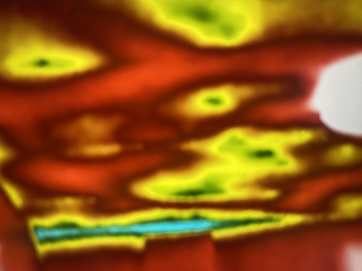 Why Metal Wins Against Alberta Hail and Wind